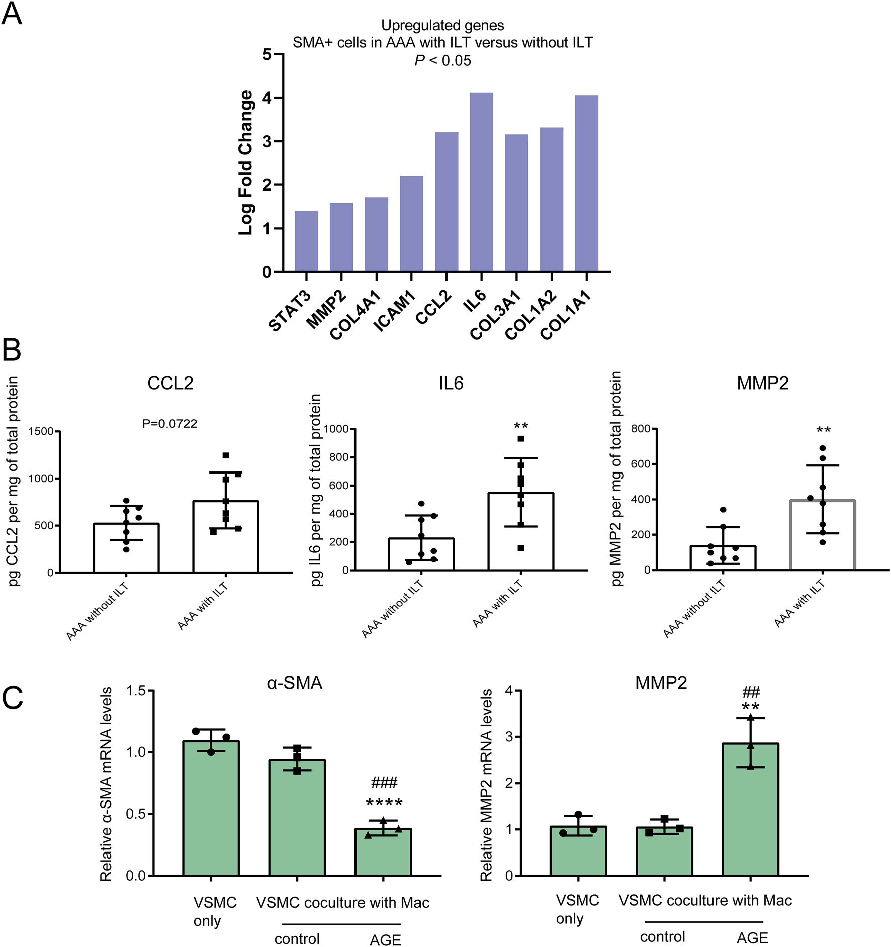 Graph A presents a bar chart showing the log fold change of upregulated genes in SMA+ cells in AAA with ILT versus without ILT, P < 0.05. Graph B contains three bar charts comparing CCL2, IL6, and MMP2 levels in AAA without ILT versus with ILT, with significance levels indicated. Graph C displays bar charts of α-SMA and MMP2 mRNA levels in VSMC conditions, highlighting differences between control and AGE, with significance levels marked.