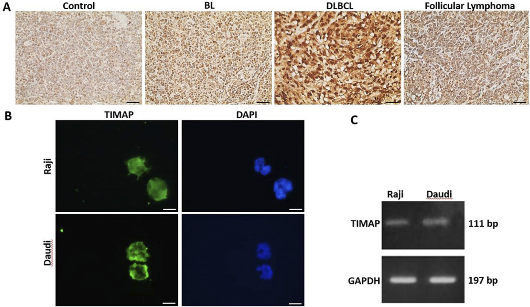Panel A shows histological images with stained tissues labeled as Control, BL, DLBCL, and Follicular Lymphoma. Panel B presents fluorescent micrographs for TIMAP and DAPI staining in Raji and Daudi cells, showing green and blue staining. Panel C exhibits gel electrophoresis results for TIMAP and GAPDH in Raji and Daudi, indicating band sizes of 111 bp and 197 bp, respectively.