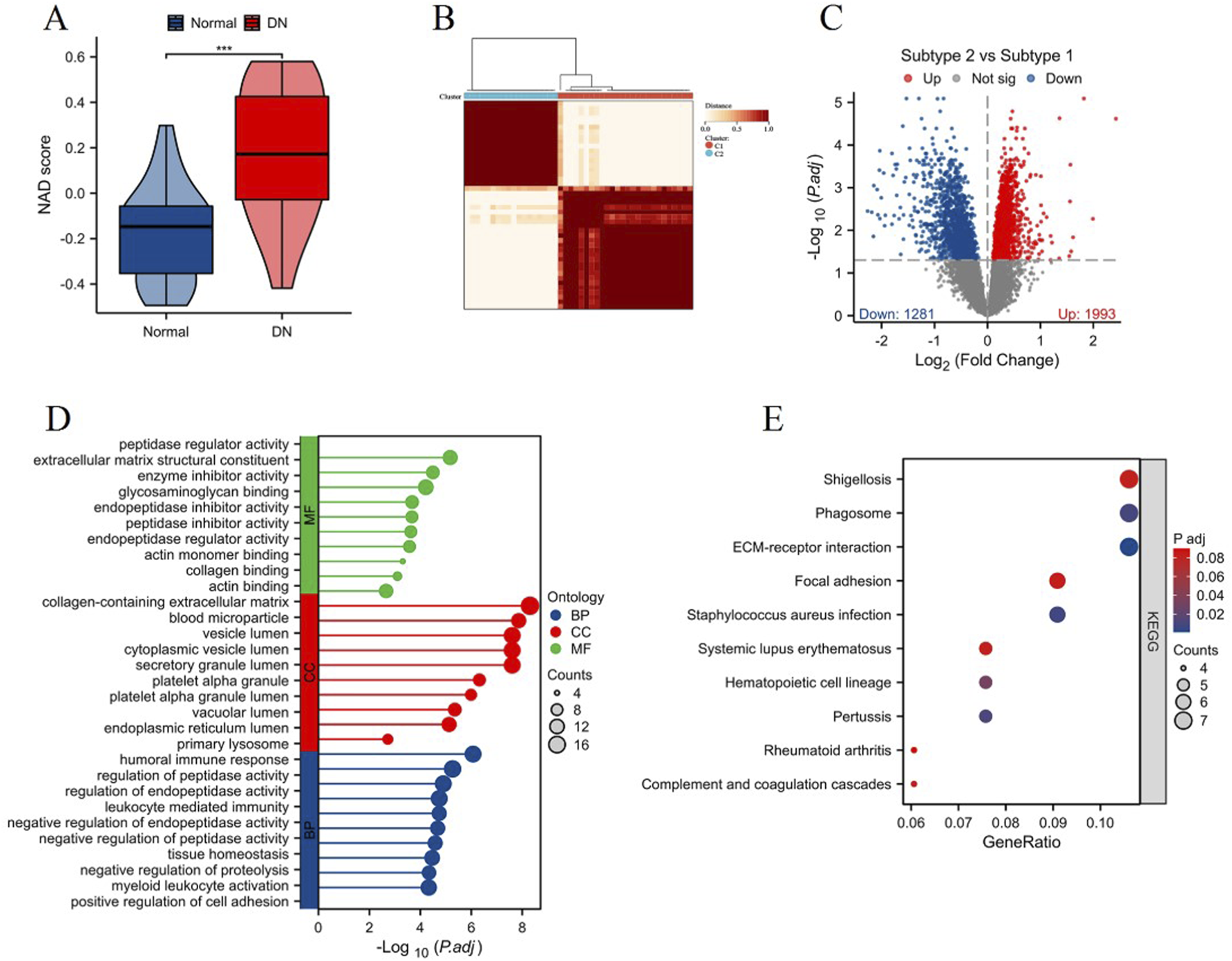 A series of five scientific data visualizations: A) Violin plot comparing NAD scores between normal and DN groups. B) Heatmap showing clustering of data. C) Volcano plot of subtype comparisons, highlighting significant gene expressions. D) Bar chart categorizing gene ontology terms into molecular functions, cellular components, and biological processes. E) Bubble plot illustrating KEGG pathway analysis with varying gene ratios and significance levels.