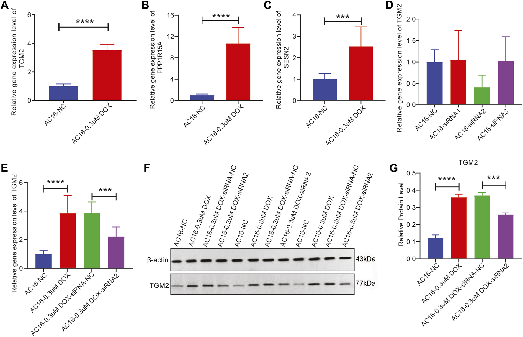 Seven-panel scientific figure showing bar graphs (A-E, G) and a western blot (F) comparing gene and protein expression levels among AC16 cell groups with various treatments including 3 micromolar doxorubicin (DOX) and siRNA knockdown. Significant upregulation of TGM2, PPP1R15A, and SESN2 genes with DOX is noted (A-C). TGM2 gene and protein expression decrease with siRNA2 treatment (D, E, G), as seen in quantitative western blot analysis (F). Statistical significance is indicated by asterisks.