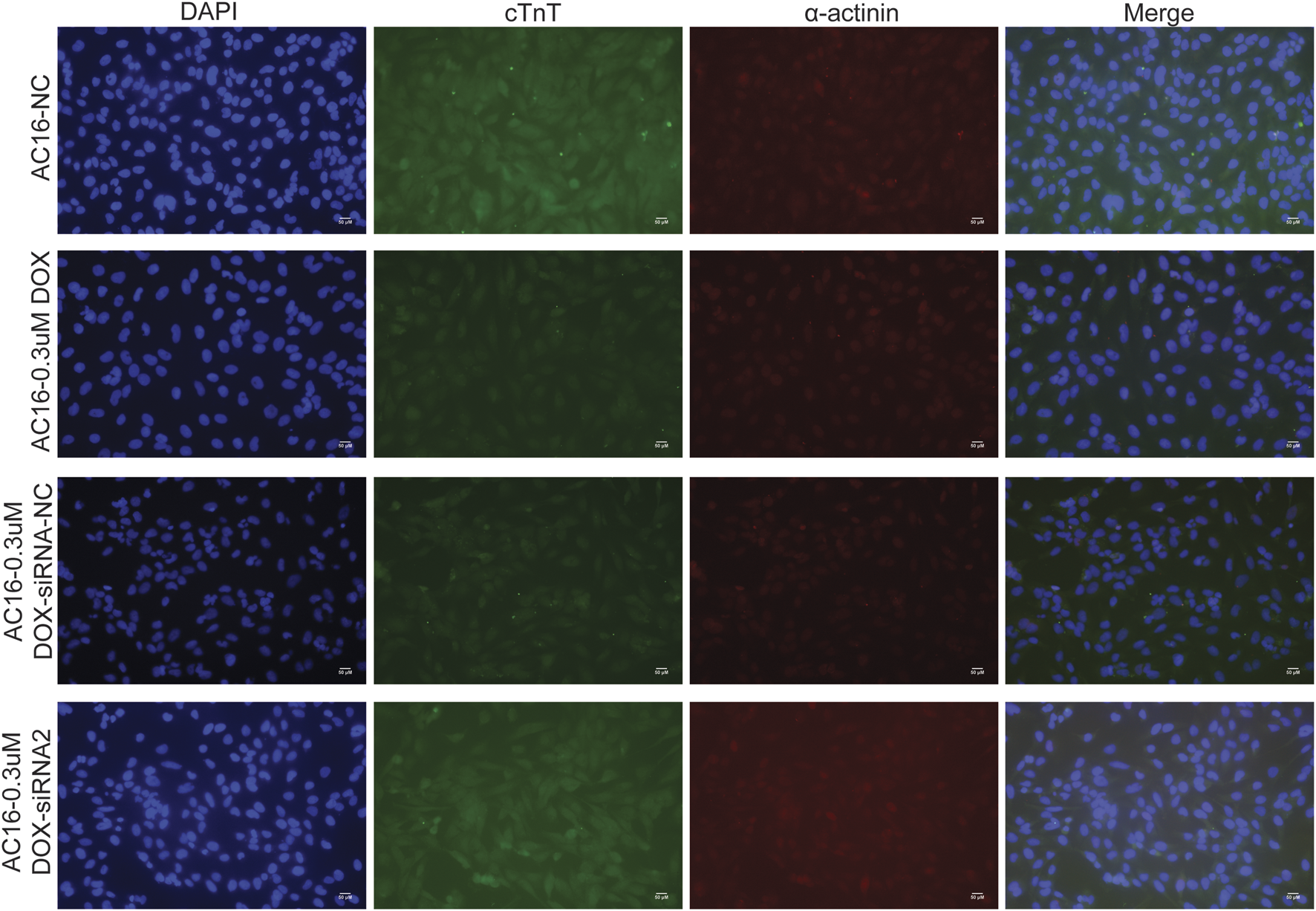 Fluorescent microscopy panel of AC16 cells under four conditions (rows: NC, 0.3μM DOX, DOX-siRNA-NC, DOX-siRNA2) showing DAPI-stained nuclei (blue), cTnT (green), α-actinin (red), and merged images in columns, illustrating cellular protein expression and nuclear morphology in each treatment group.