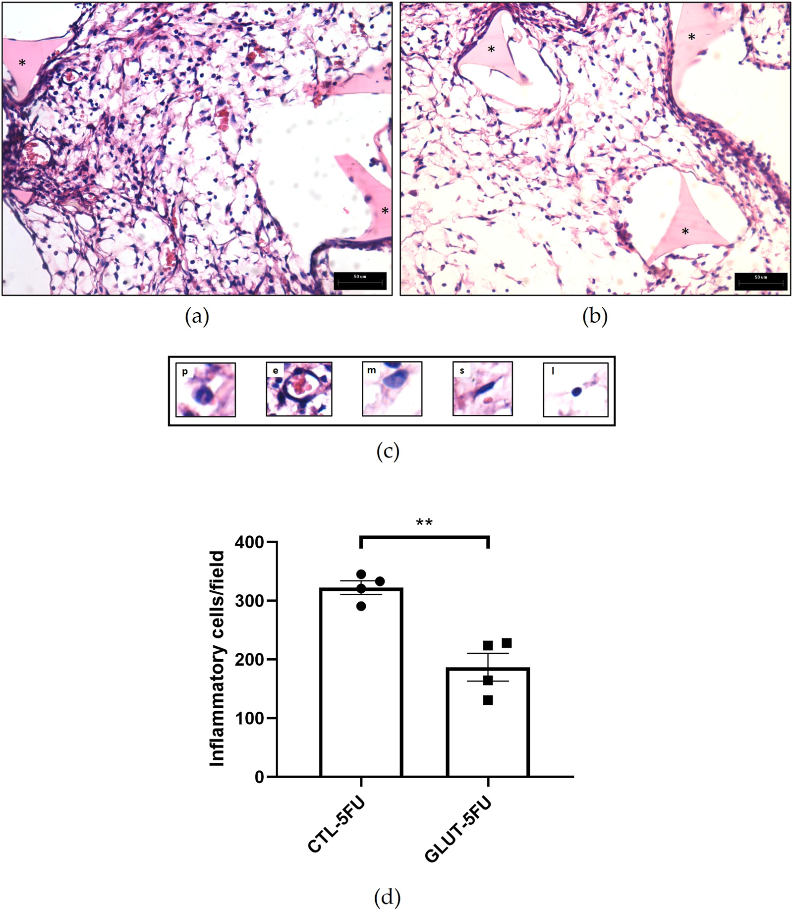 Two histology micrographs labeled (a) and (b) display tissue samples with visible cell nuclei and extracellular matrix, marked with asterisks indicating regions of interest. A panel labeled (c) contains five close-up images of different cell types labeled p, e, m, s, l. Below, a bar graph labeled (d) compares inflammatory cell counts per field between CTL-5FU and GLUT-5FU groups, showing a significant reduction in the GLUT-5FU group, indicated by a double asterisk.