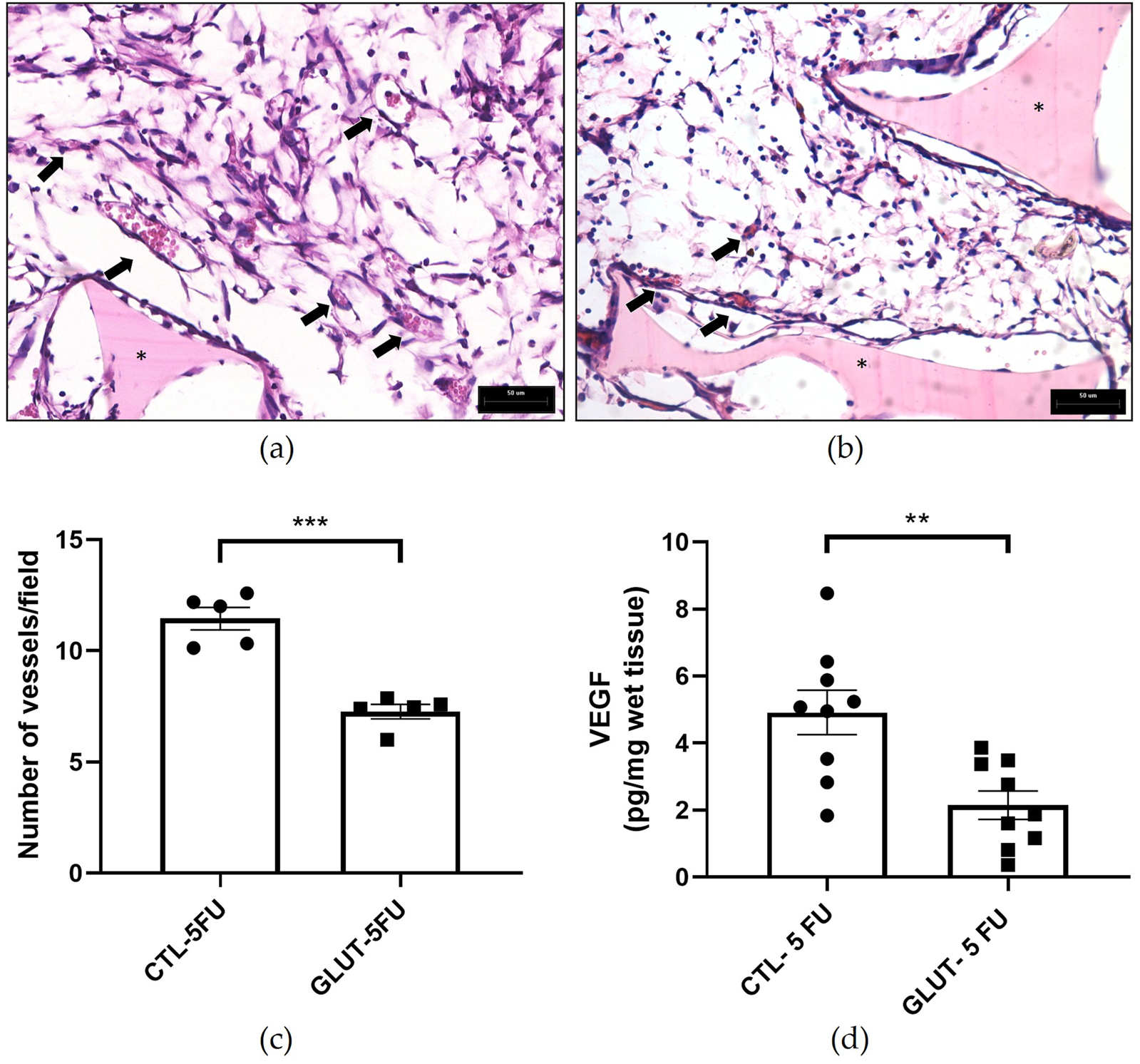 Panel a and panel b show histological sections of tissue labeled with black arrows and asterisks, comparing vascular structures between CTL-5FU and GLUT-5FU groups. Panel c is a bar graph showing a significantly higher number of vessels per field in the CTL-5FU group compared to the GLUT-5FU group. Panel d is a bar graph showing higher VEGF levels in CTL-5FU compared to GLUT-5FU, with statistical significance indicated by asterisks.