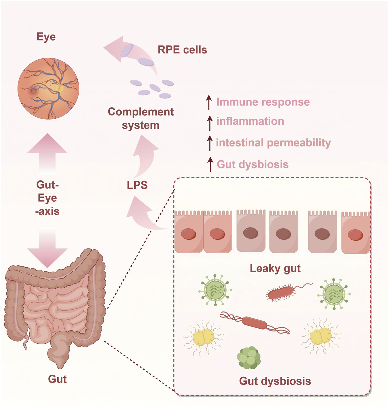 Diagram illustrating the gut-eye axis connection. The gut is linked to the eye via RPE cells, complement system, and LPS. It shows increasing immune response, inflammation, intestinal permeability, and gut dysbiosis, represented by a leaky gut with bacterial images.